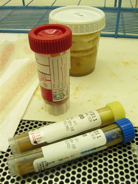 laboratory analysis of stool sample|how stool test is done.